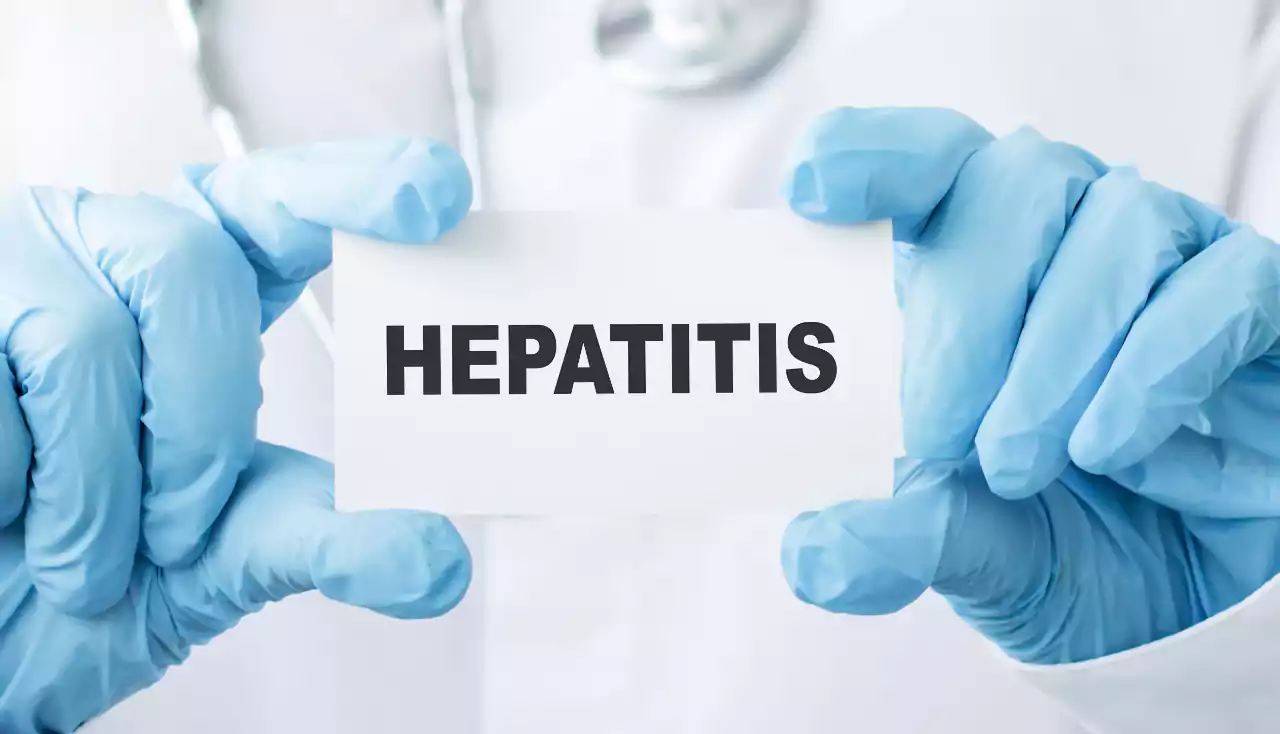 Doctor holding sign with text HEPATITIS closeup. Medical concept